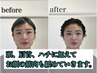 【岡山・倉敷初】骨格補正スパ:TOTAL 90[まつおか指名限定ヘッドスパ]