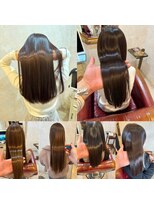 シールド(Shield)&nbsp;メテオ矯正1