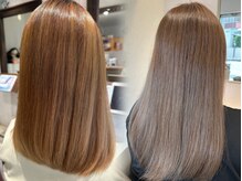 ビーフォーユー(B4U)