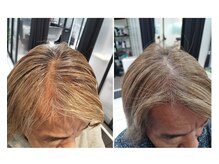 【根本的な改善には継続を】まずは半年～１年続けていきましょう。【戸越銀座/髪質改善/育毛促進】