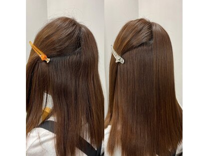 アルファ(ALPHA)の写真