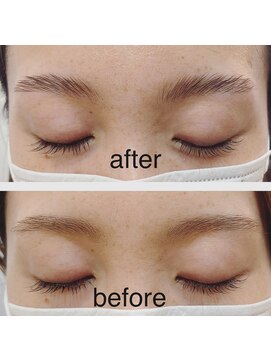 デスト 大宮(DEST) ナチュラルブローリフト