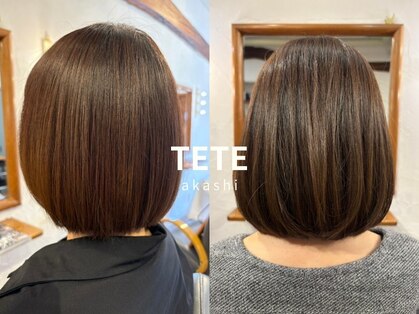 テテ(TETE)の写真