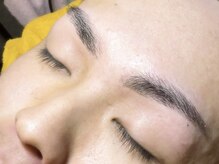 トータルビューティーバルフィット(BALFIT)