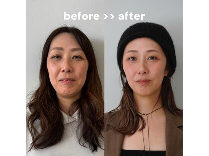 ビセラ(Vicella)の写真