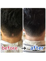 ブルーフィン シセロ(Blue Fin cicero) 頭皮改善!育毛促進ケア