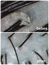 【マイクロスコープカウンセリング】頭皮の状態をお客様と一緒に確認。お悩みの状況を診断いたします。