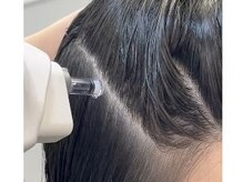 最新《エア・インジェクション》ヒト幹細胞を頭皮の奥まで届ける