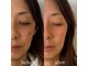 ビセラ(Vicella)の写真