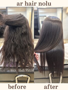 アールヘアノル(ar hair nolu) 髪質改善縮毛矯正 5