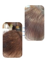 ユーフォルムギンザ(y-Forme Ginza)&nbsp;髪質改善ストレート♪トキカタも使用！