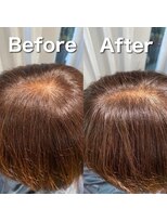 ツムグ 代官山 中目黒(TUMUGU)&nbsp;分け目が気になる方・地肌見え解消/ボリュームアップエクステ