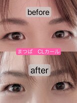 アローズ(arose)&nbsp;マツパ