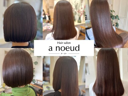 ア ヌー(a noeud)の写真