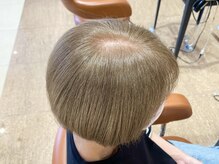 【エイジングケア】ハリ・コシを与えるケア