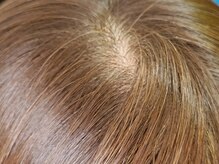 ◇その３◇ボリュームが出ない