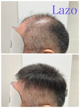 シートヘアースタイル