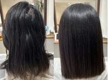 エン(enn)
