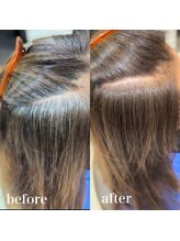 地肌が特に弱い方はゼロテク対応も可能