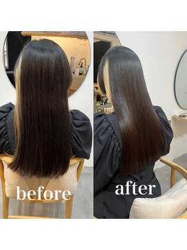 アイ 代々木公園(aye) 水素トリートメント