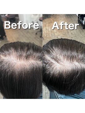 ツムグ 代官山 中目黒(TUMUGU) 地肌見え・つむじ割れ解消/ボリュームアップエクステ