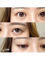 イルム(iLM)&nbsp;【 eye 】