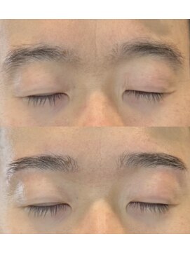 バブルー(bubblue) メンズハリウッドブロウリフト