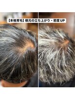 ブラン(Blanc。)&nbsp;薬に頼らない本格育毛促進ケア