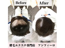抜毛症の解消実績◎他店で断られた方もご相談ください。