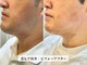 カミケンオム(kamiken. homme)の写真