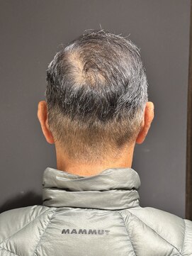 ヒロギンザ 大阪本店(HIRO GINZA) 刈り上げサイドパート