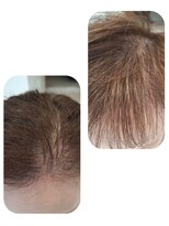 ユーフォルムギンザ(y-Forme Ginza)&nbsp;話題のトキカタ♪前髪編