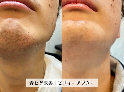 カミケンオム(kamiken. homme)の写真