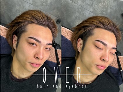 オーバー(OVER)の写真