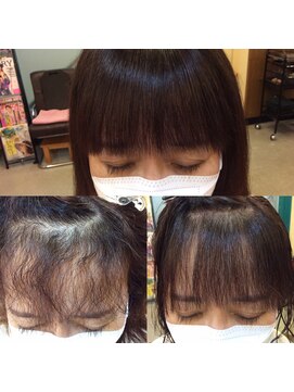 ケークラフト(K-craft) フルバング