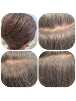 ユーフォルムギンザ(y-Forme Ginza)&nbsp;カラーエステ♪白髪ぼかしカラー