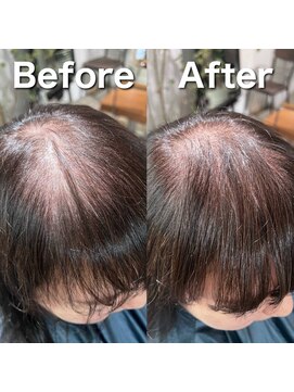 ツムグ 代官山 中目黒(TUMUGU) 前髪割れ・地肌見え解消/ボリュームアップエクステ