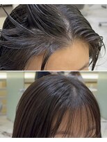 マージュ ギンザ(marju GINZA) 生えぐせ解消プロセス