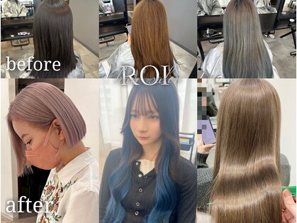 ロイ(ROI)の写真