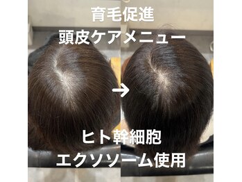 Levin【レヴィン】