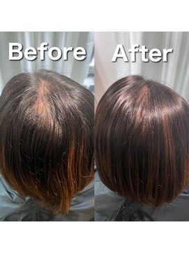 ツムグ 代官山 中目黒(TUMUGU) 地肌見え・つむじ割れ解消/ボリュームアップエクステ