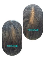 ユーフォルムギンザ(y-Forme Ginza) トキカタ根元補正♪