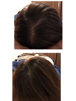 ショートヘアー