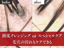 アイスタイル 戸坂店(I STYLE)の雰囲気（クレンジングで頭皮から美しく［白髪染め/トリートメント/40代］）