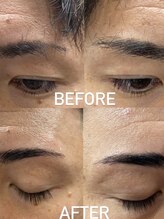 ライズヘアーバズ(RAIZE HAIR BUZZ)