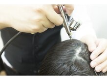 最新のエクソソーム頭皮改善が大好評！