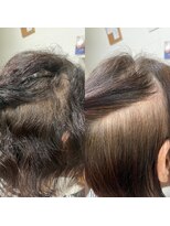 アットライク(@like)&nbsp;70代・初めての縮毛矯正　細毛も自然な丸みとツヤ