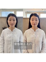 カミベヤ(KAMIBEYA)&nbsp;骨格補正スパ2回目