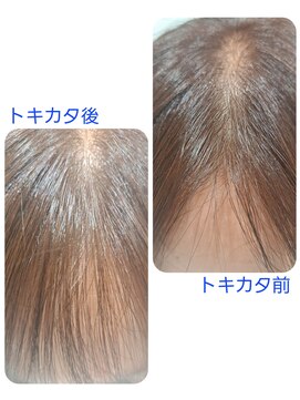 ユーフォルムギンザ(y-Forme Ginza) 話題のトキカタ♪前髪編