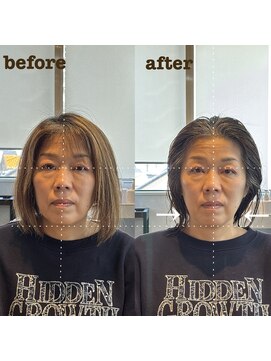 ザラメ(ZARAME) 骨格補正スパ
